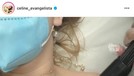 Proses Penghapusan Tato Celine Evangelista Proses Penghapusan Tato Celine Evangelista