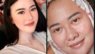 Terungkap Wajah Virgita Si Pembunuh Suami Sebelum Oplas, Bikin Syok!