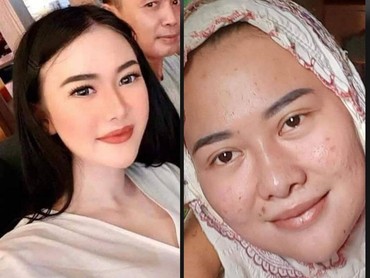 img-title Permak Muka Ratusan Juta, Virgita Pembunuh Suami Disebut Mirip Lucinta Luna
