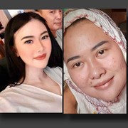 Terungkap Wajah Virgita Legina Sebelum Melakukan Perawatan Kecantikan Jutaan Rupiah