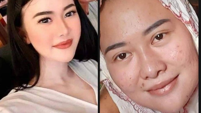 Terungkap Wajah Virgita Legina Sebelum Melakukan Perawatan Kecantikan Jutaan Rupiah