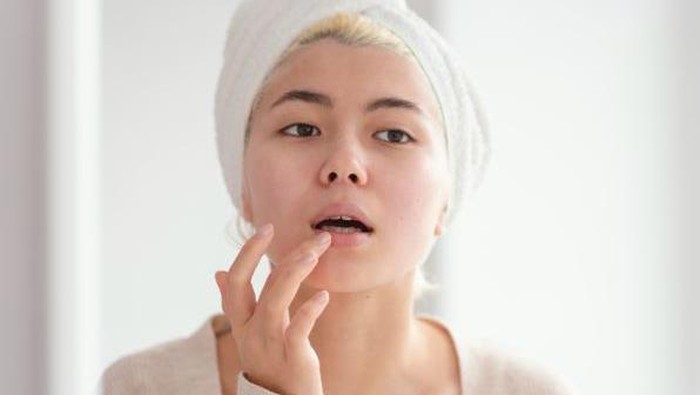 5 Kiat Mudah Cegah Bibir Pecah-pecah Selama Bulan Puasa