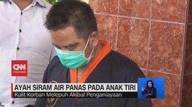 VIDEO: Ayah Siram Air Panas Pada Anak Tiri