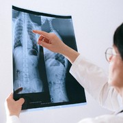 Tingkatkan Kualitas Paru-Paru, Ini Jurus yang Bisa Kamu Lakukan