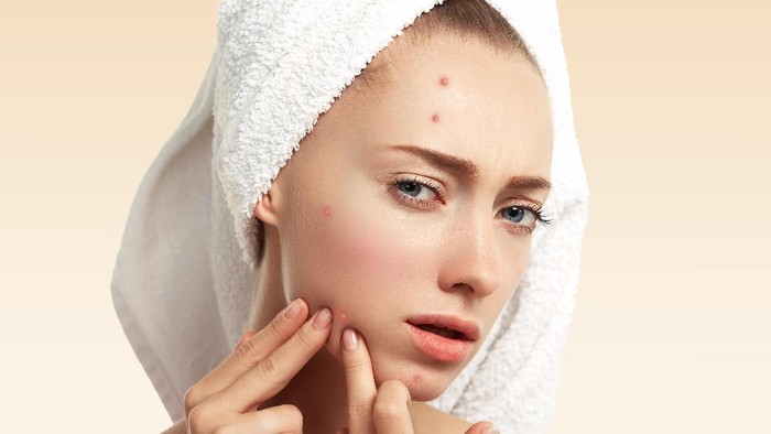 5 Alasan Jerawat Terasa Gatal, Jangan Asal Garuk atau Pencet!