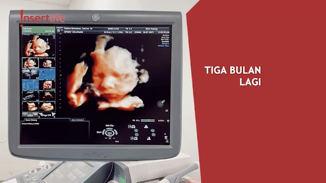 Pamer Hasil USG Patricia Devina, Billy Davidson Siap Jadi Ayah