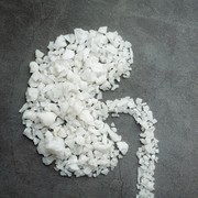 Perempuan Usia 20an di Jateng Mengaku Gagal Ginjal karena Jarang Minum Air Putih! Begini Penjelasan dari Sisi Medisnya