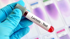 Mengenal Asidosis Laktat yang Dikaitkan dengan Covid-19