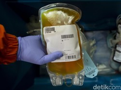 Plasma Konvalesen Terapi Penyembuh COVID-19