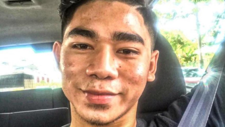 Transformasi wajah pria jerawatan viral