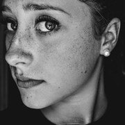 Ketahui 4 Penyebab Flek Hitam yang Bisa Kamu Hindari Mulai Sekarang