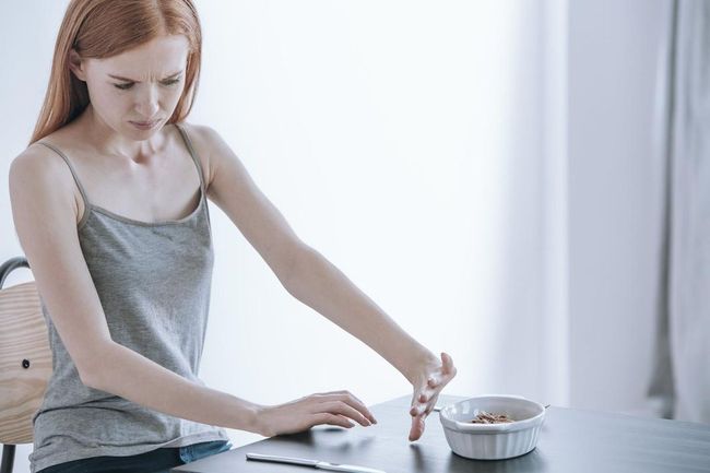 SamaSama "Takut Makan", Ini Bedanya Cibophobia dan Anorexia