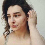 Sering Dianggap Sama, Kenali Perbedaan Masalah Kulit Wajah Purging dan Breakout