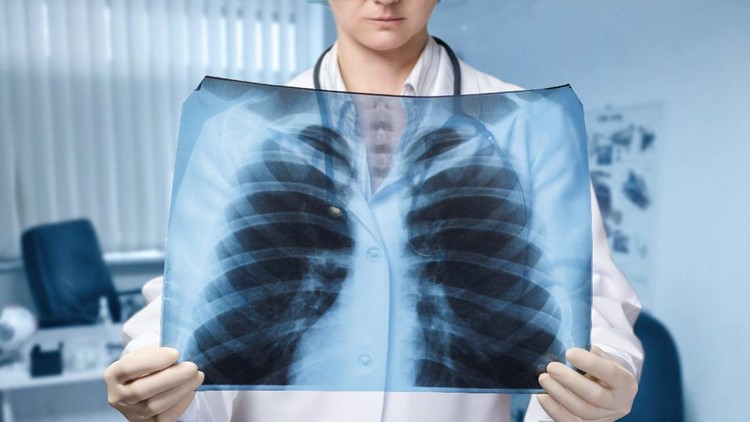 A young doctor is standing and looking at the lungs image at the blurred hospital room background. The concept of medical service, diagnosis and treatment.