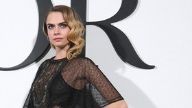 Rumah Cara Delevingne Kebakaran, 2 Kucing Peliharaan Selamat