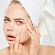 Kiat Mudah Mengurangi Pembentukan Sebaceous Filaments, Bintik di Hidung Mirip Komedo