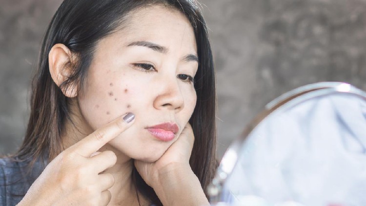 unhappy Asian woman checking her face skin problem with dark spot from scar acne