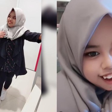 Intip Penampilan Terbaru Kekeyi Tuai Pujian, Pipi Tirus Makin Langsing