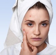 5 Kebiasaan Saat Mandi Ini Ternyata Malah Berisiko Timbulkan Jerawat!