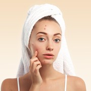 Alasan Kenapa Jerawat Sering Muncul Sebelum Menstruasi dan Cara Mengatasinya