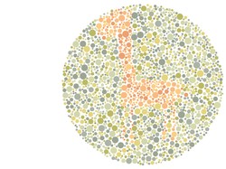 Kelihatan Nggak? Cuma yang Punya Mata Tajam yang Bisa Lihat Hewan di Gambar Ini