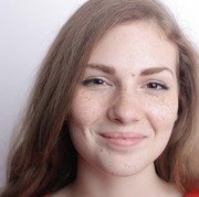 Simak Perbedaan Melasma dan Age Spots yang Sering Disalahpahami Orang