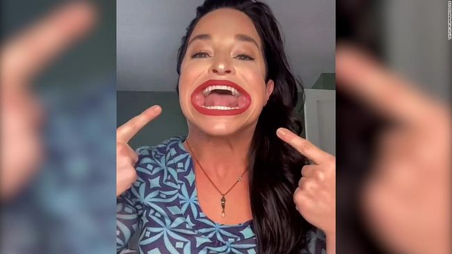 Tak ada yang bisa mengalahkan besarnya mulut milik wanita asal Connecticut, Samantha Ramsdell. Bahkan hal ini disahihkan oleh Guinness World Records.