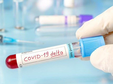 3 Fakta COVID-19 Varian Delta, Mutasi Paling Berbahaya & Muncul di Indonesia