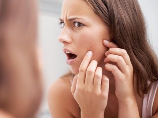 Bekas Jerawat Nggak Hilang-hilang? Cek Cara Pilih Serum Dark Spot Sesuai