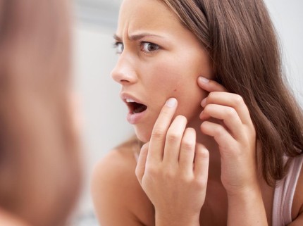 7 Skincare Alami untuk Menghilangkan Noda Bekas Jerawat di Wajah
