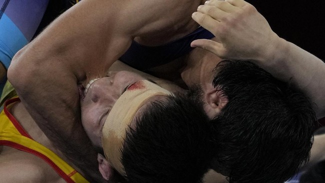 Pegulat India, Ravi Kumar mendapat gigitan lawan di bagian lengan saat berduel lawan Nurislam Sanayev di Olimpiade Tokyo.