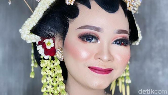 Jelang pernikahan, wajah pengantin ini penuh luka dan sukses bikin pangling saat hari pernikahan.