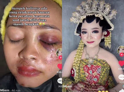 MUA Dandani Pengantin Luka Parah Usai Kecelakaan, Hasilnya Bikin Pangling