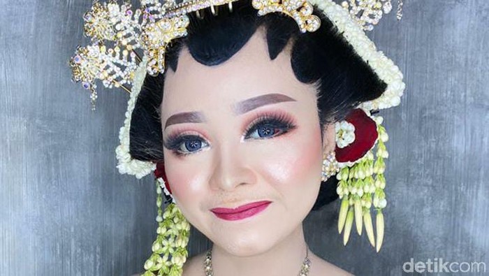 Jelang pernikahan, wajah pengantin ini penuh luka dan sukses bikin pangling saat hari pernikahan.