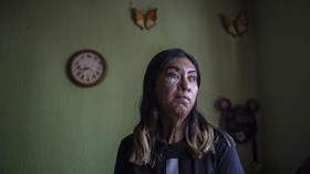 FOTO: Suara Perempuan Penyintas Serangan Air Keras di Meksiko