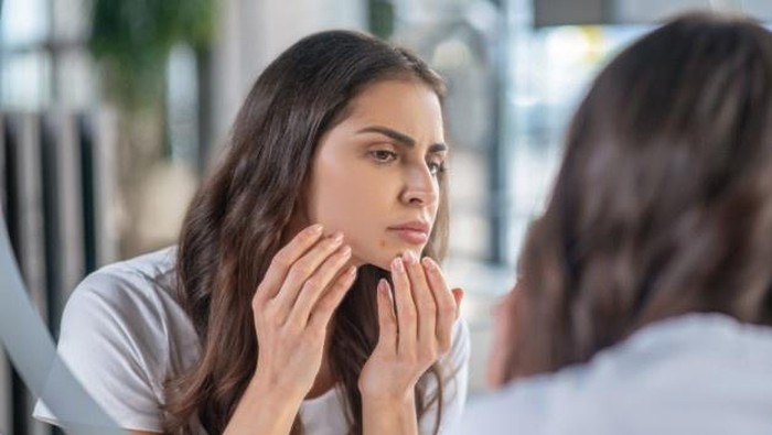 Mitos Atau Fakta, Terlalu Sering Bercermin Bisa Bikin Wajah Jerawatan? Ini Penjelasan Ilmiahnya