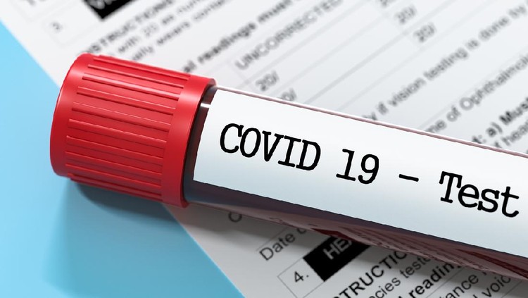 Ilustrasi virus covid atau corona Corona Virus test report Stock Image, Test tube