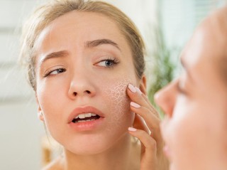 Kulit Kering dan Iritasi Ringan? Ini 5 Cara Pakai Moisturizer Balm Multifungsi yang