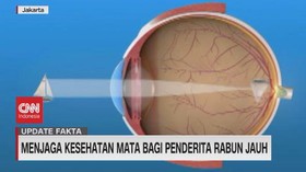 VIDEO: Menjaga Kesehatan Mata Bagi Penderita Rabun Jauh