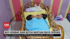 VIDEO: Bayi Kembar Siam Butuh Bantuan Biaya Operasi