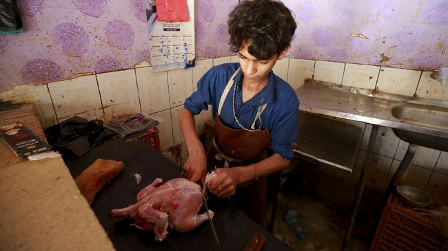 FOTO: Banting Tulang Anak-anak Yaman Hidup di Tanah Perang