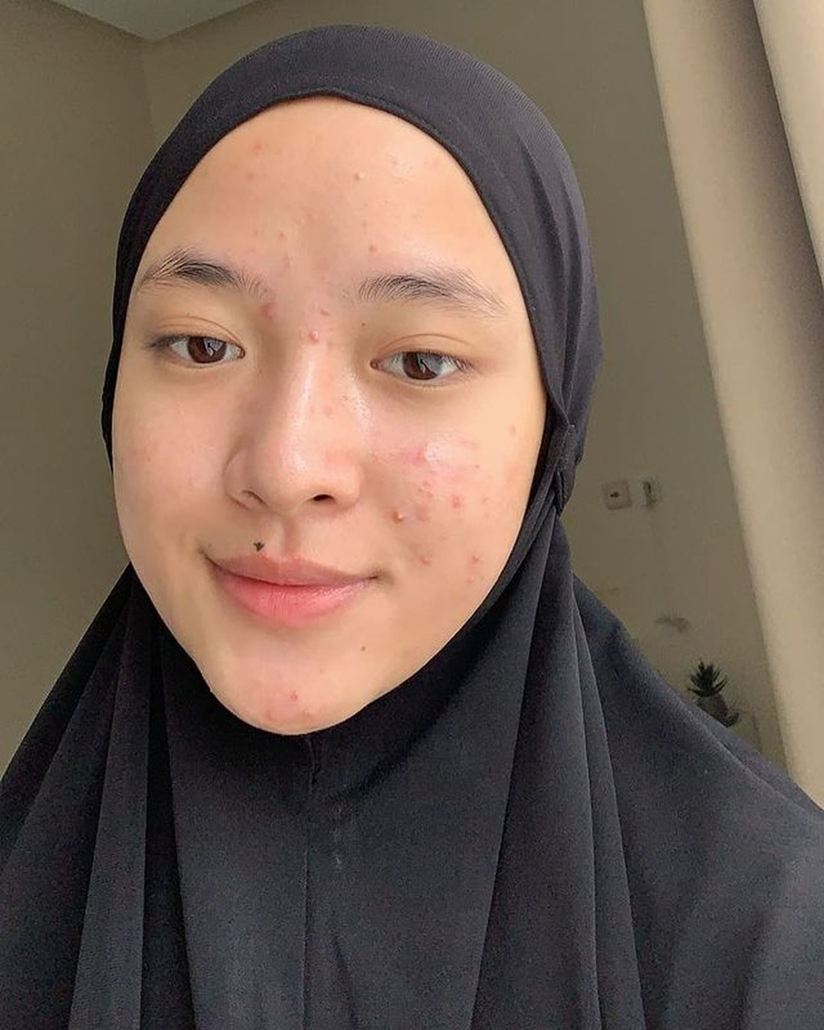 Nissa Sabyan mengunggah penampakan wajahnya yang tak biasa dan terlihat beda&period; Yuk kita lihat&excl;