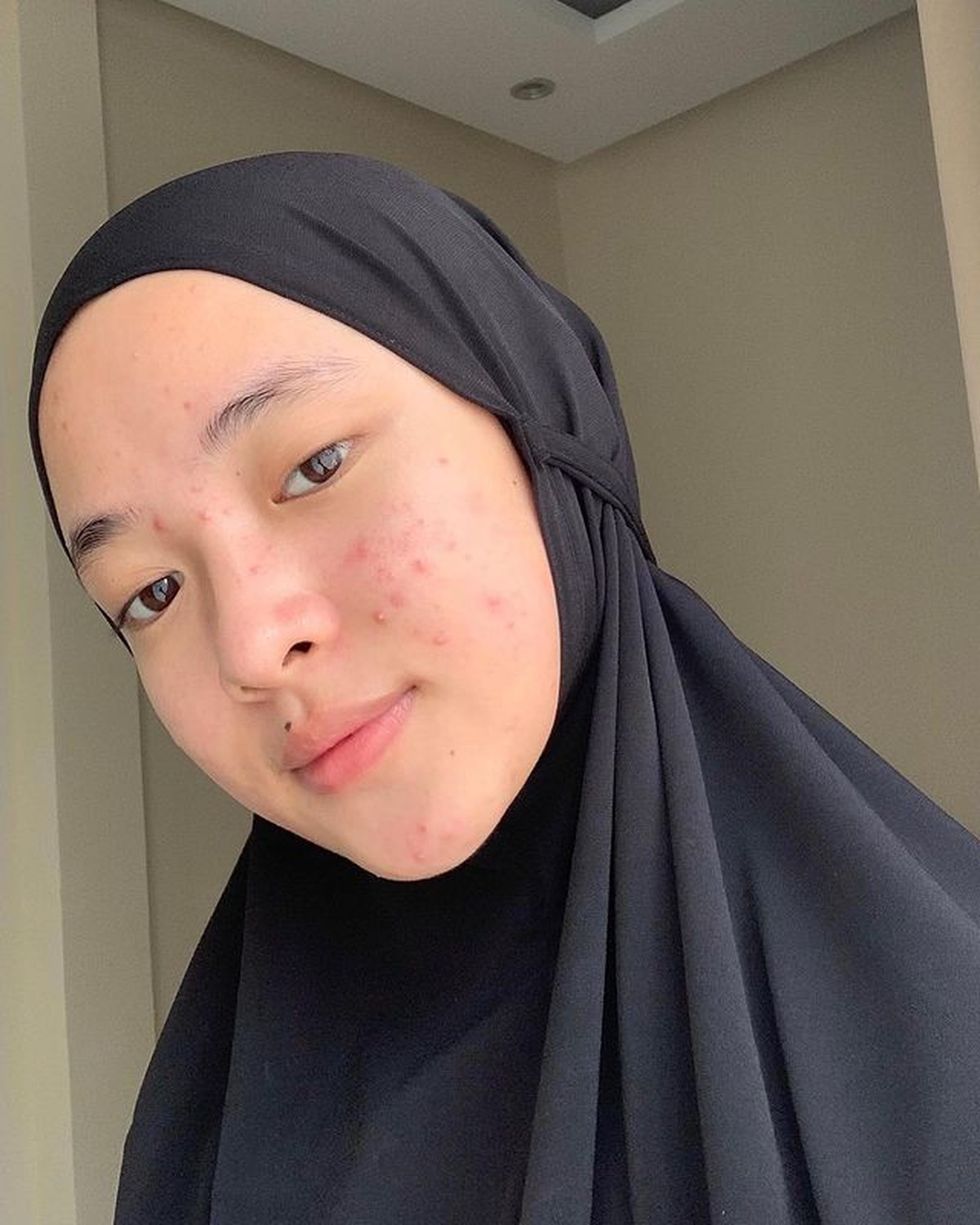 Nissa Sabyan mengunggah penampakan wajahnya yang tak biasa dan terlihat beda&period; Yuk kita lihat&excl;