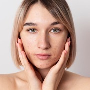 4 Rekomendasi Masker Organik BPOM, Tuntaskan Jerawat dan Masalah di Wajah Lainnya