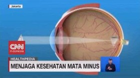 VIDEO: Menjaga Kesehatan Mata Minus