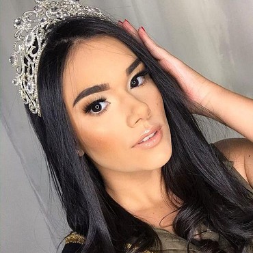 Pilu, Ratu Kecantikan Ini Meninggal Saat Jalani Operasi Angkat Tumor