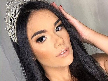 Pilu, Ratu Kecantikan Ini Meninggal Saat Jalani Operasi Angkat Tumor