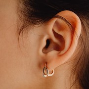 Perempuan Berusia 18 Tahun Keluhkan Sakit Telinga dalam Waktu Lama Ternyata Didiagnosis Stroke, Ini Penjelasannya