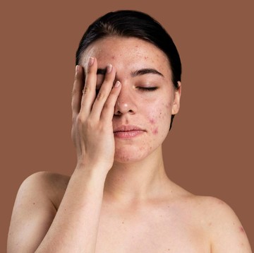 Kembalikan Kulit Wajah Sehat Mulus, 4 Rekomendasi Skincare Lokal Ini Ampuh Atasi Maskne Selama Pandemi
