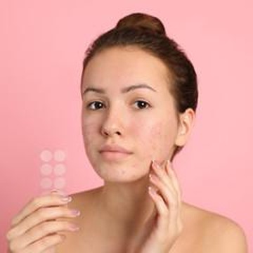 7 Rekomendasi Acne Patch Terbaik